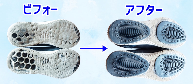 ビフォーアフター